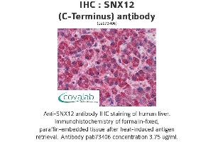 Image no. 1 for anti-Sorting Nexin 12 (SNX12) (C-Term) antibody (ABIN1739487) (SNX12 anticorps  (C-Term))