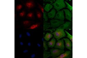 ABIN7094437 and ABIN7098485 staining  cells by IF/ICC.