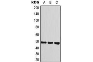 Western blot analysis of Histamine H3 Receptor expression in HeLa (A), A549 (B), Raw264. (HRH3 anticorps  (Center))