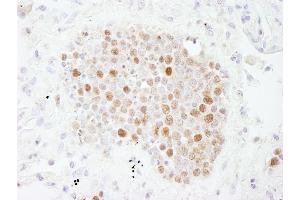 anti-Chromatin Assembly Factor 1, Subunit B (p60) (CHAF1B) (C-Term) antibody