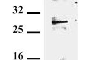 Detection of endogenous tollip in murine EL-4. (TOLLIP anticorps)
