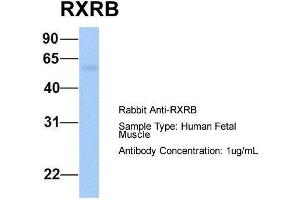 Host:  Rabbit  Target Name:  RXRB  Sample Type:  Human Fetal Muscle  Antibody Dilution:  1. (Retinoid X Receptor beta anticorps  (N-Term))