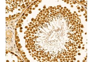 ABIN6261344 and ABIN6269035 at 1/100 staining Rat testis tissue by IHC-P. (DNMT3B anticorps  (N-Term))