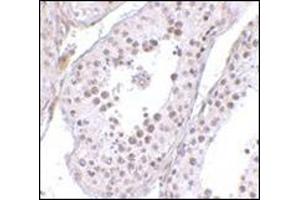 Immunohistochemistry of MED4 in human testis tissue with this product at 10 μg/ml. (MED4 anticorps  (C-Term))