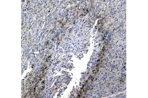 IHC analysis of Synaptotagmin 1 using anti-Synaptotagmin 1 antibody .