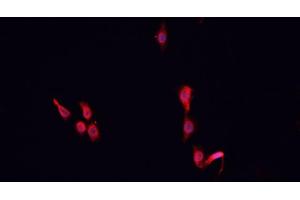 ABIN6266521 staining MCF-7 cells by IF/ICC.