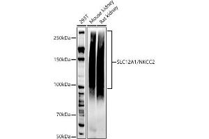 Western blot analysis of extracts of various cell lines, using SLC12/NKCC2 antibody (ABIN7270400) at 1:1000 dilution.