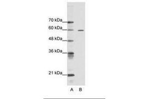 Image no. 1 for anti-AT Rich Interactive Domain 3A (BRIGHT-Like) (ARID3A) (AA 339-388) antibody (ABIN6736104) (ARID3A anticorps  (AA 339-388))