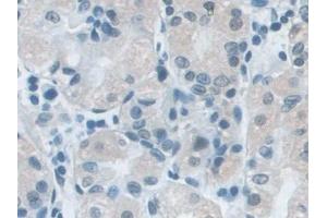 Detection of SNRPD1 in Human Stomach Tissue using Polyclonal Antibody to Small Nuclear Ribonucleoprotein Polypeptide D1 (SNRPD1) (SNRPD1 anticorps  (AA 1-119))