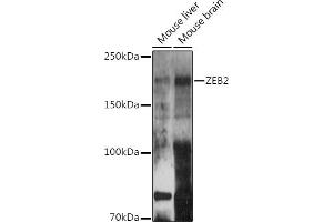 Western blot analysis of extracts of various cell lines, using ZEB2 antibody (ABIN6131480, ABIN6150424, ABIN6150425 and ABIN6221369) at 1:500 dilution. (ZEB2 anticorps  (AA 1050-1214))