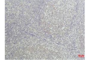 Immunohistochemistry (IHC) analysis of paraffin-embedded Human Tonsil Tissue using TNF a Mouse Monoclonal Antibody diluted at 1:50. (TNF alpha anticorps)