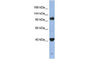 WB Suggested Anti-EIF2C4 Antibody Titration: 0. (AGO4 anticorps  (Middle Region))