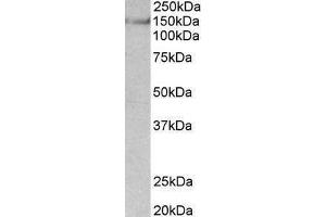 ABIN870656 (0. (SYNGAP1 anticorps  (AA 1169-1183))