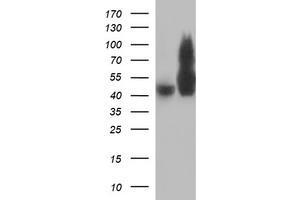 Image no. 1 for anti-Tubulin, beta 2B (TUBB2B) antibody (ABIN1501573) (TUBB2B anticorps)