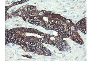 Image no. 13 for anti-Diphthamide Biosynthesis Protein 2 (DPH2) antibody (ABIN1497891)