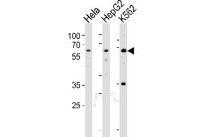 Western blot analysis of lysates from Hela, HepG2, K562 cell line (from left to right), using RIOK3 Antibody (Center) (ABIN6243990 and ABIN6577652). (RIOK3 anticorps  (AA 146-179))
