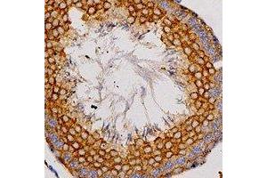 Immunohistochemical analysis of Adenosine A2a Receptor staining in human testis formalin fixed paraffin embedded tissue section.