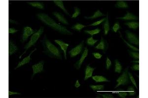 Immunofluorescence of monoclonal antibody to COX6C on HeLa cell.