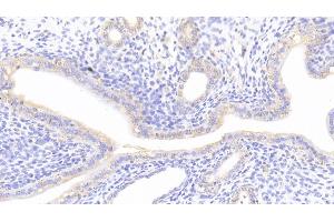 Detection of NFE2L2 in Rat Uterus Tissue using Polyclonal Antibody to Nuclear Factor, Erythroid Derived 2 Like Protein 2 (NFE2L2) (NRF2 anticorps  (AA 382-604))
