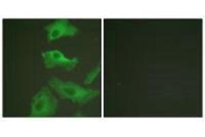 Immunofluorescence analysis of HeLa cells, treated with TNF-a (20nM, 15 mins), using HSP90B (Ab-254) antibody.