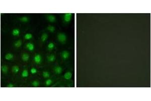 Immunofluorescence analysis of HuvEc cells treated with serum 20% 30', using DNA-PK (Phospho-Thr2647) Antibody.