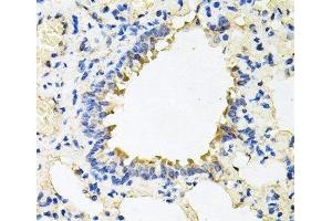 Immunohistochemistry of paraffin-embedded Rat lung using CALU Polyclonal Antibody at dilution of 1:100 (40x lens). (CALU anticorps)