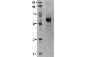 Validation with Western Blot (GALE Protein (Transcript Variant 1) (His tag))