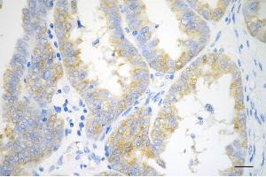 anti-CSE1 Chromosome Segregation 1-Like (CSE1L) antibody