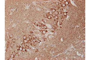 Immunostaining of paraffin embedded sections of mouse hippocampus (dilution 1 : 100). (Dynamin 1, 2, 3 (AA 2-17) anticorps)