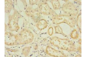 Immunohistochemistry of paraffin-embedded human kidney tissue using ABIN7175887 at dilution of 1:100