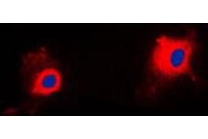 Immunofluorescent analysis of PIG11 staining in HuvEc cells. (TP53I11 anticorps  (Center))