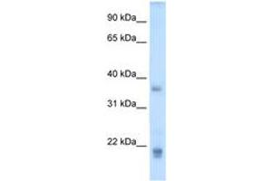 Image no. 1 for anti-Growth Hormone 2 (GH2) (C-Term) antibody (ABIN204981) (Growth Hormone 2 anticorps  (C-Term))