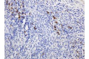 Image no. 2 for anti-Ribophorin II (RPN2) antibody (ABIN1500757)