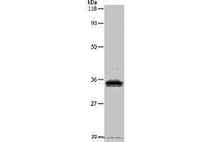 Western blot analysis of 293T cell, using UPK3B Polyclonal Antibody at dilution of 1:1000 (Uroplakin 3B anticorps)