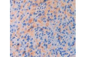 IHC-P analysis of pancreas tissue, with DAB staining. (IL18R1 anticorps  (AA 182-336))