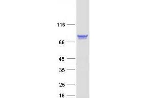 Validation with Western Blot