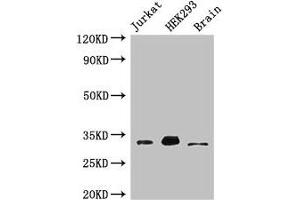 Western Blot Positive WB detected in: Jurkat whole cell lysate, HEK293 whole cell lysate, Mouse brain tissue All lanes: MBD3 antibody at 3 μg/mL Secondary Goat polyclonal to rabbit IgG at 1/50000 dilution Predicted band size: 33, 30 kDa Observed band size: 33 kDa (MBD3 anticorps  (AA 79-209))