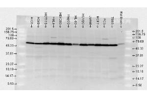 Western blot analysis of Human, Rat brain cell lysates showing detection of HSP70 protein using Rabbit Anti-HSP70 Polyclonal Antibody .