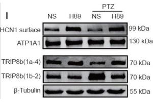 Western blotting results showing TRIP8b (1a-4), and TRIP8b(1b-2) labeling in hippocampal CA1 region of control group rats either treated with saline or a PKA inhibitor(H89) and pentylenetetrazole (PTZ) treated rats under the same experimental conditions.