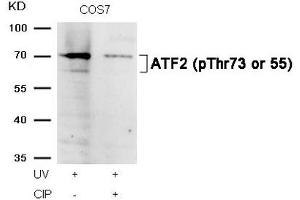 Western blot analysis of extracts from COS7 cells, treated with UV or calf intestinal phosphatase (CIP), using ATF2 (Phospho-Thr73 or 55) Antibody.