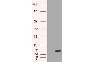 HEK293T cells were transfected with the pCMV6-ENTRY control (Left lane) or pCMV6-ENTRY TTC32 (Right lane) cDNA for 48 hrs and lysed. (TTC32 anticorps)