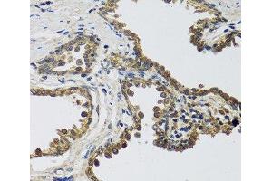 Immunohistochemistry of paraffin-embedded Human prostate using IL25 Polyclonal Antibody at dilution of 1:100 (40x lens). (IL-25 anticorps)