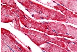 Human Skeletal Muscle (formalin-fixed, paraffin-embedded) stained with PYGM antibody ABIN213350 at 20 ug/ml followed by biotinylated goat anti-rabbit IgG secondary antibody ABIN481713, alkaline phosphatase-streptavidin and chromogen. (PYGM anticorps  (C-Term))