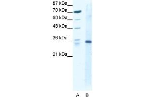 WB Suggested Anti-KLF3 Antibody Titration:  1.