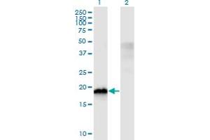Western Blot analysis of CIRBP expression in transfected 293T cell line by CIRBP monoclonal antibody (M03), clone 1C9. (CIRBP anticorps  (AA 1-90))