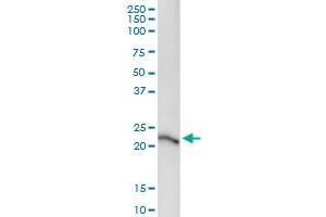 Immunoprecipitation of SENP8 transfected lysate using anti-SENP8 MaxPab rabbit polyclonal antibody and Protein A Magnetic Bead , and immunoblotted with SENP8 monoclonal antibody (M06), clone 2E1 .