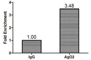 Chromatin Immunoprecipitation Hela (1.