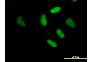 Immunofluorescence of purified MaxPab antibody to RFX3 on HeLa cell.
