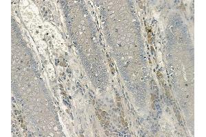 ABIN6256669 and ABIN6267133 at 1/100 staining human normal colon tissue by IHC-P. (LAT anticorps  (pTyr200))
