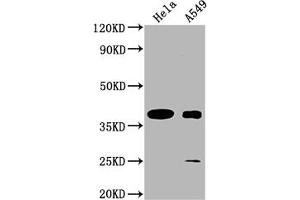 Western Blot Positive WB detected in: Hela whole cell lysate, A549 whole cell lysate All lanes: TAS2R7 antibody at 1:2000 Secondary Goat polyclonal to rabbit IgG at 1/50000 dilution Predicted band size: 37 kDa Observed band size: 37 kDa